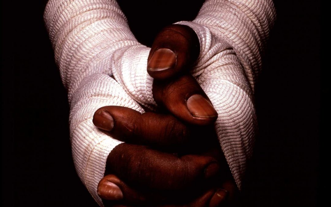 Boxer’s Hands