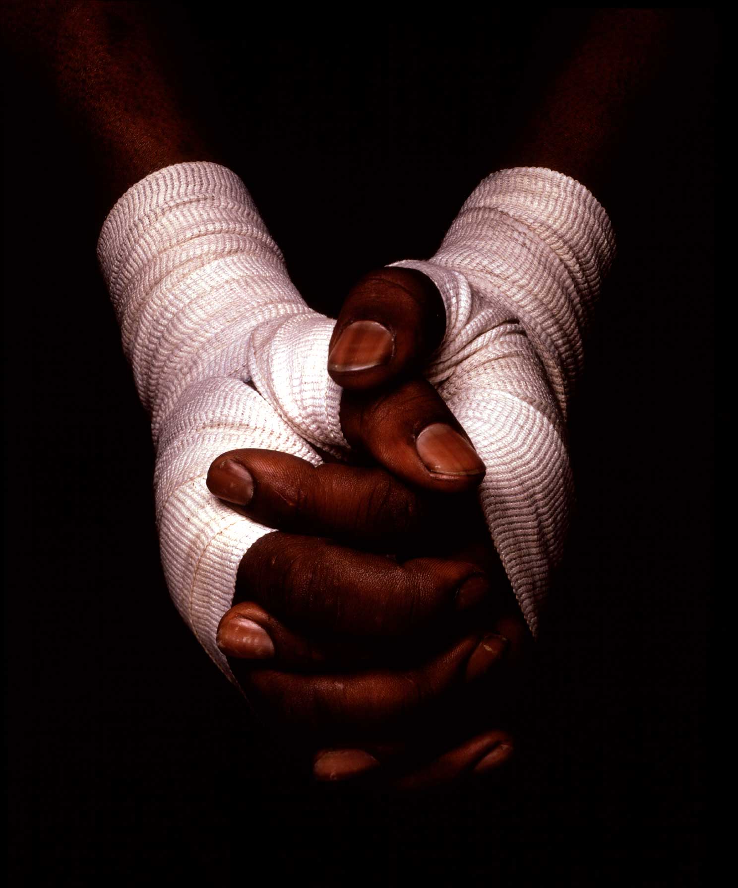 Boxer’s Hands